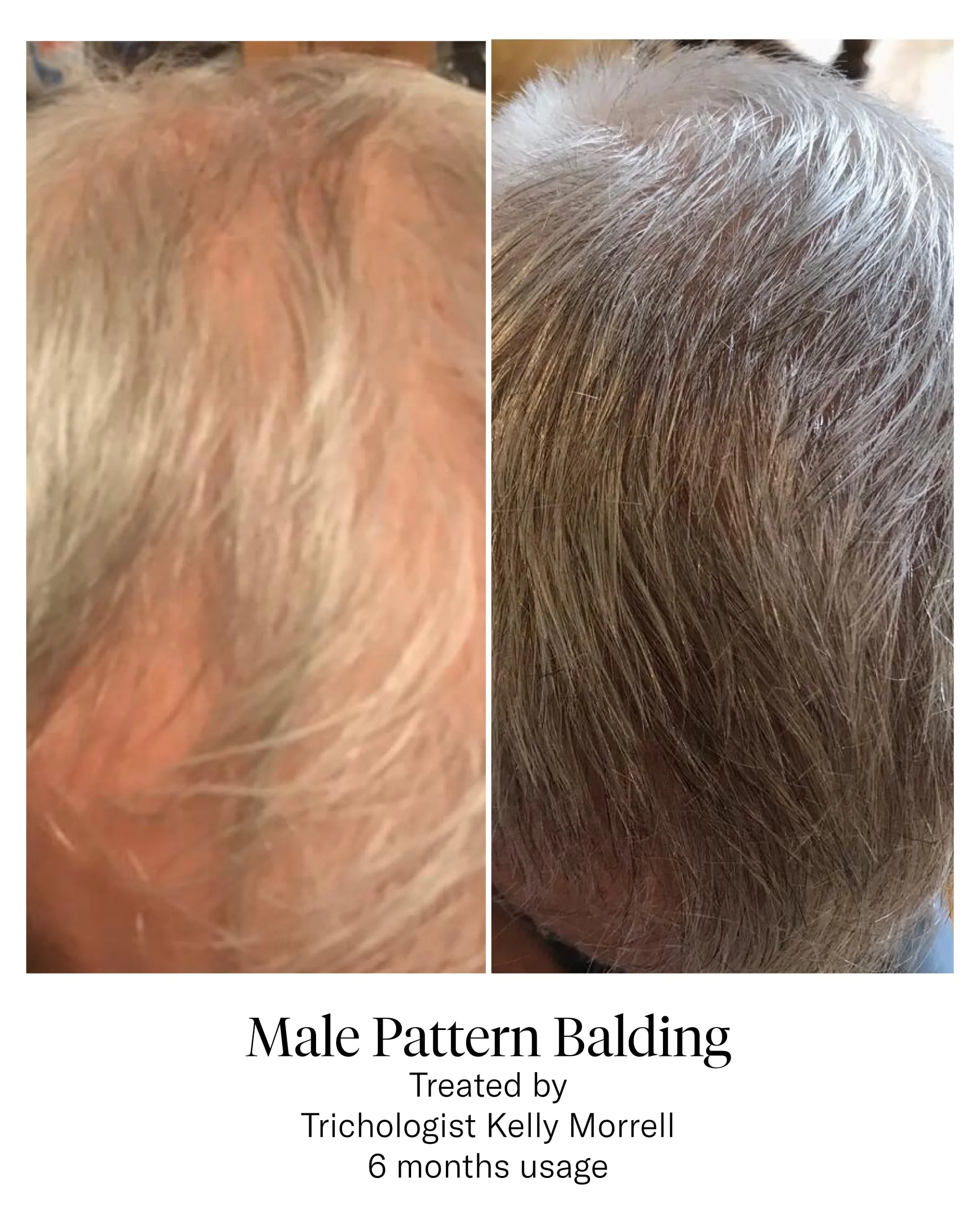 Hair Serum - Image 5