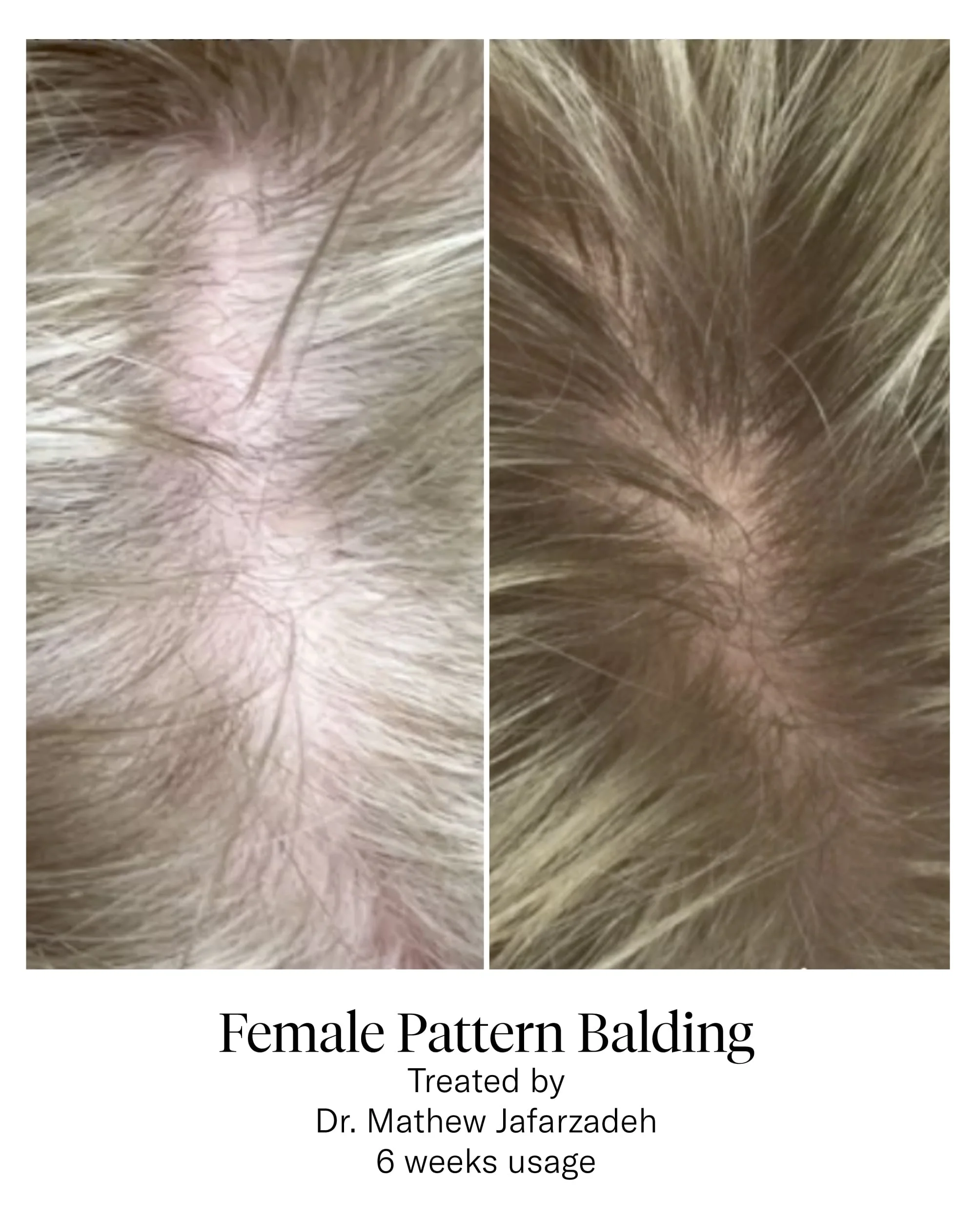 Hair Serum - Image 7