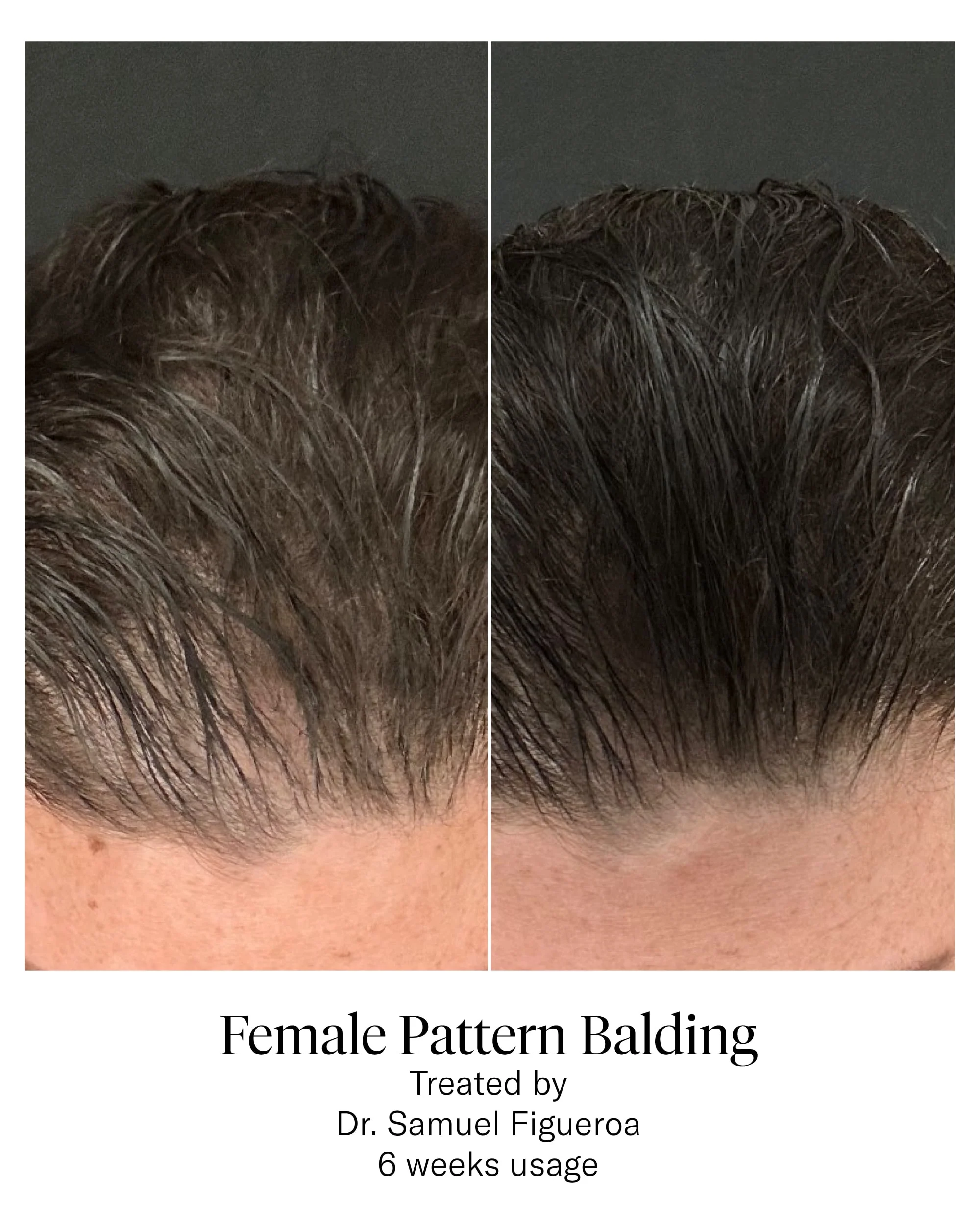 Hair Serum - Image 9